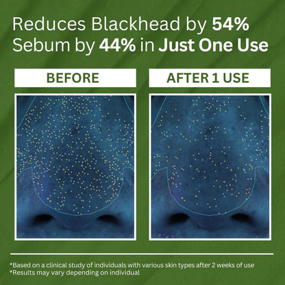 FizzAura™ Holy Basil Bubble Deep Mask