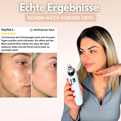 PorePurify™ Porenpflege