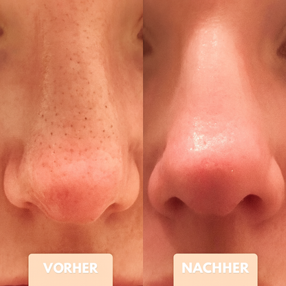 PorePurify™ Porenpflege